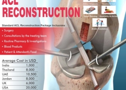 Best ACL Reconstruction Treatment in India