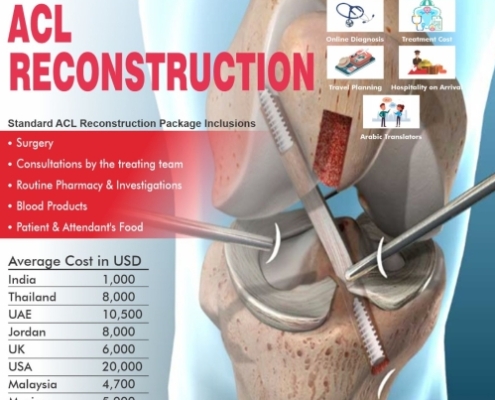 Cost of ACL Reconstruction in India