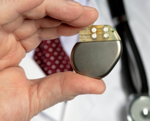 doctor holding the pacemaker