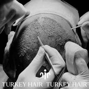 Turkey Hair Cener