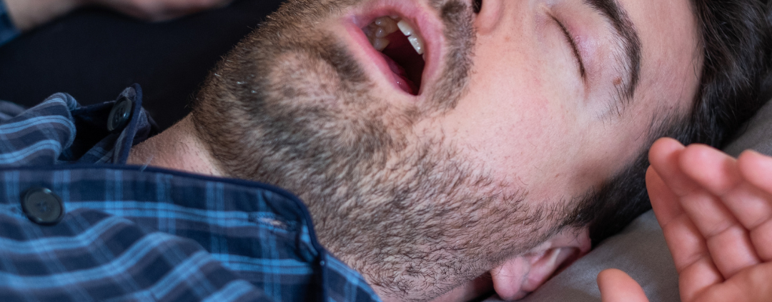 man snoring - a symptom of sleep apnea