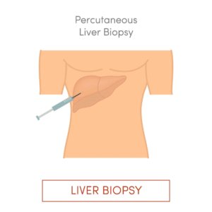 Percutaneous Liver surgery
