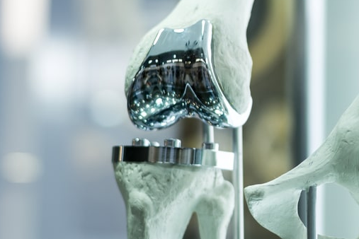 knee replacement metal rod