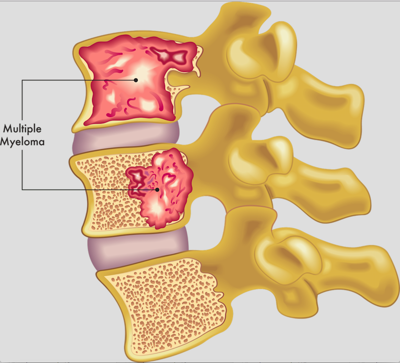Diagram of a bone marrow