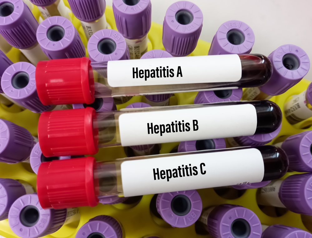 Types of Hepatitis