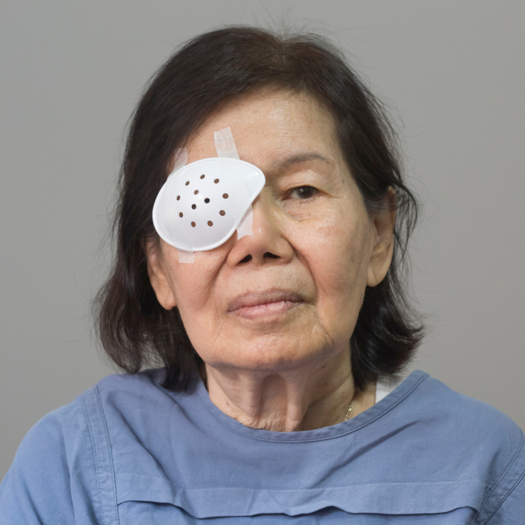 after a cataract operation