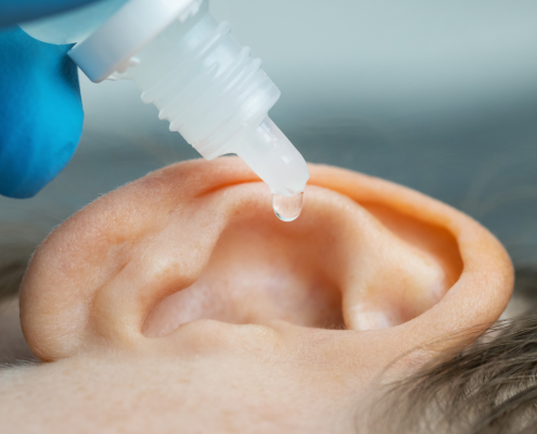 earwax removal by using eardrops