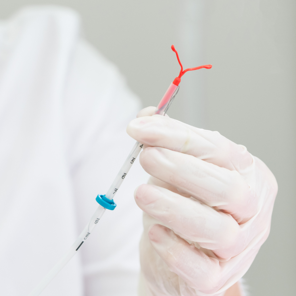 IUD as a birth control measure