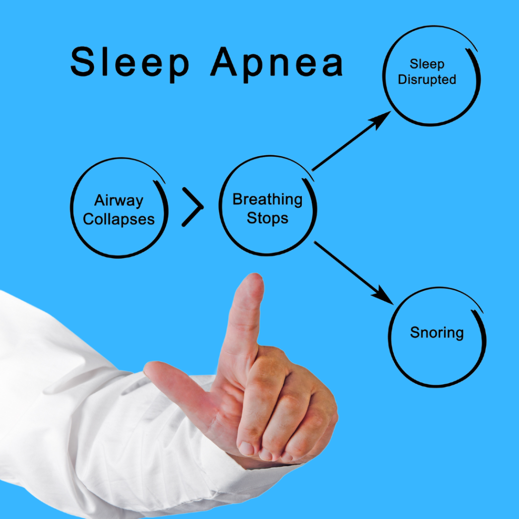 sleep apnea diagram