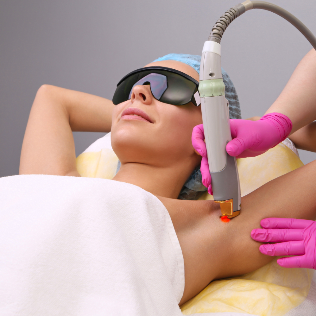 laser therapy for dark underarms
