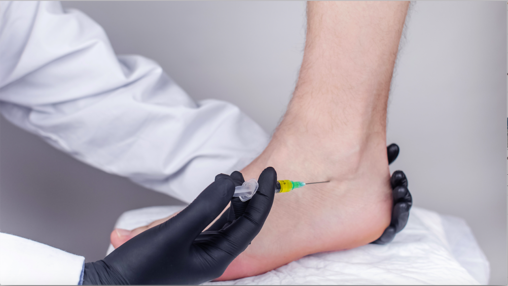 a numbing injection to deal with achilles tendon injury pain